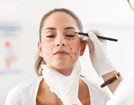 facelift-gelaat-hals-behandeling