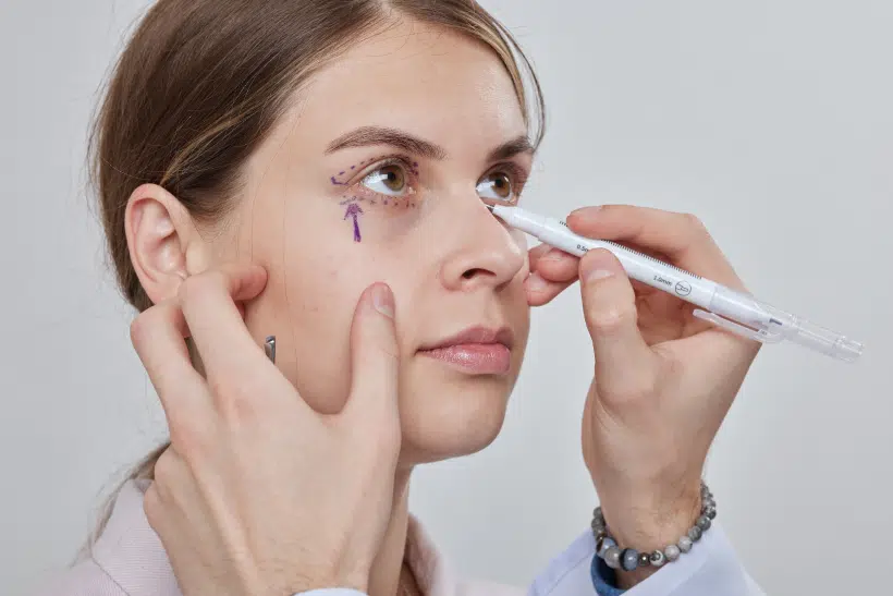 plastic-surgeon-prepares-for-blepharoplasty-bleph-2024-01-10-23-46-10-utc 1
