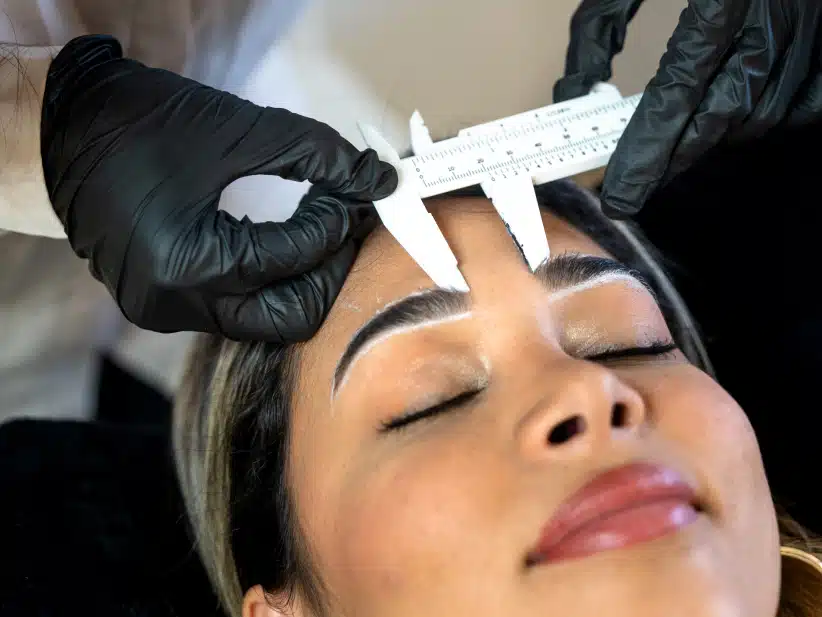 eyebrow lift